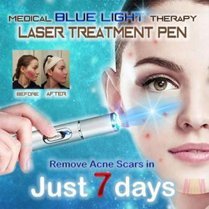 Blue Light Laser Pen - Doctor Wellington